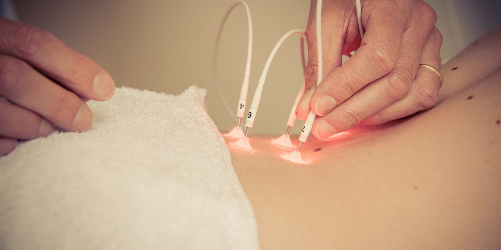 acupunctuur bij de behandeling van kanker