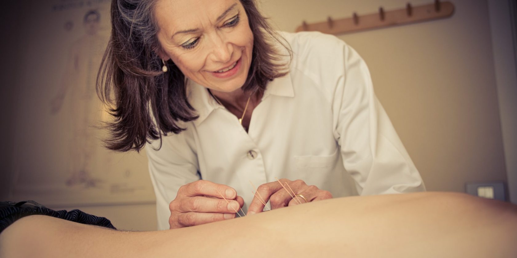 Acupunctuur bij infertiliteit